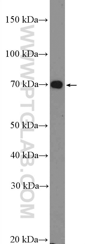 Western Blot (WB) analysis of HepG2 cells using HGSNAT Polyclonal antibody (12399-1-AP)