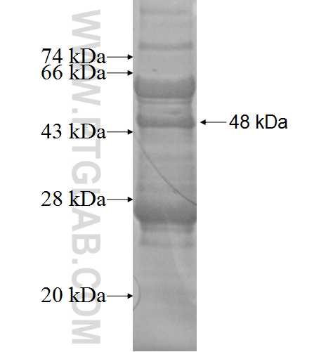 HGSNAT fusion protein Ag3089 SDS-PAGE