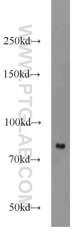 Western Blot (WB) analysis of HEK-293 cells using HHIP Polyclonal antibody (11654-1-AP)