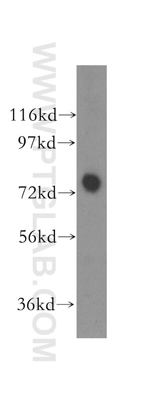 Western Blot (WB) analysis of HEK-293 cells using HHIP Polyclonal antibody (11654-1-AP)