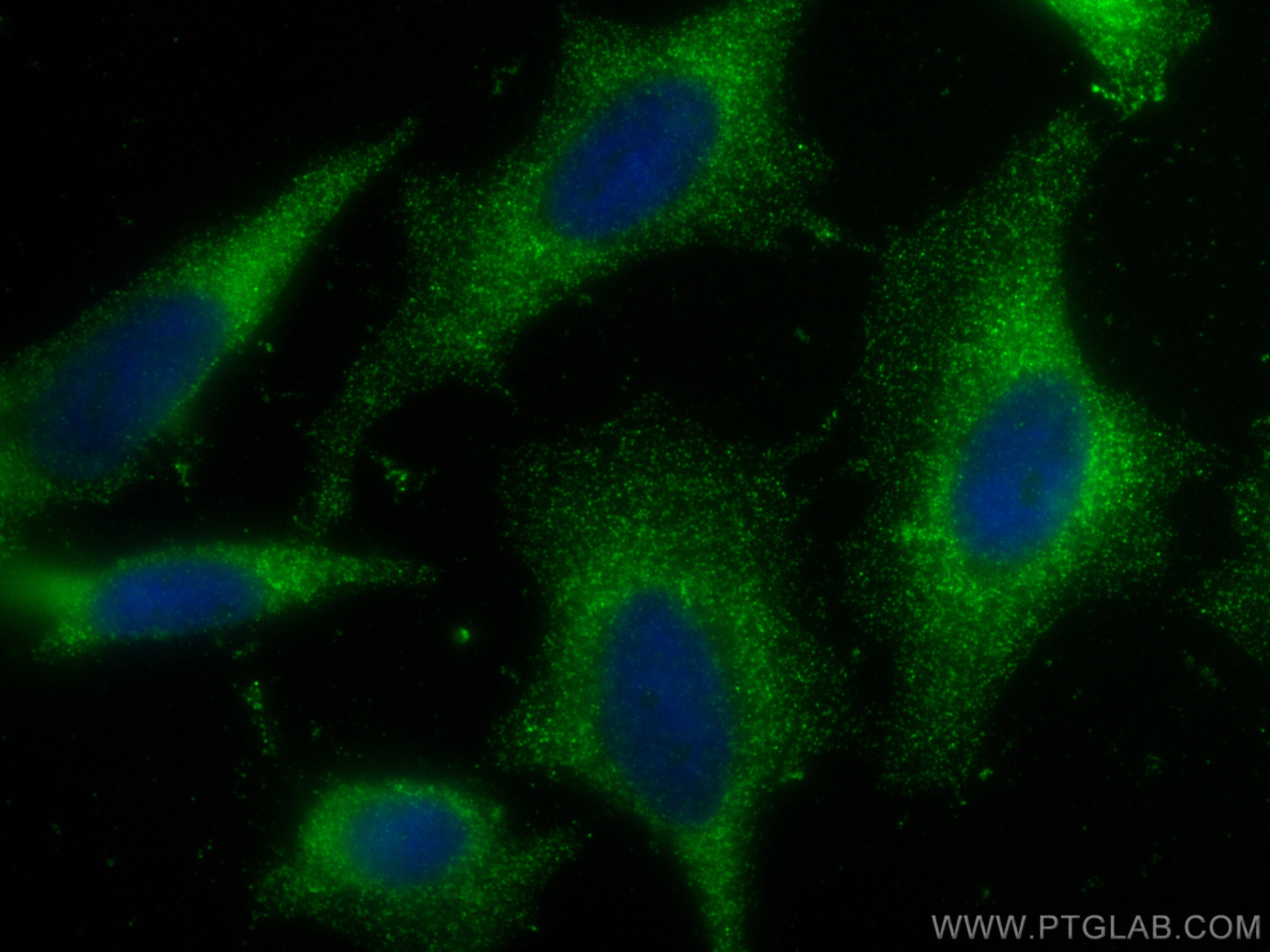 Immunofluorescence (IF) / fluorescent staining of HeLa cells using HHIP Polyclonal antibody (29466-1-AP)