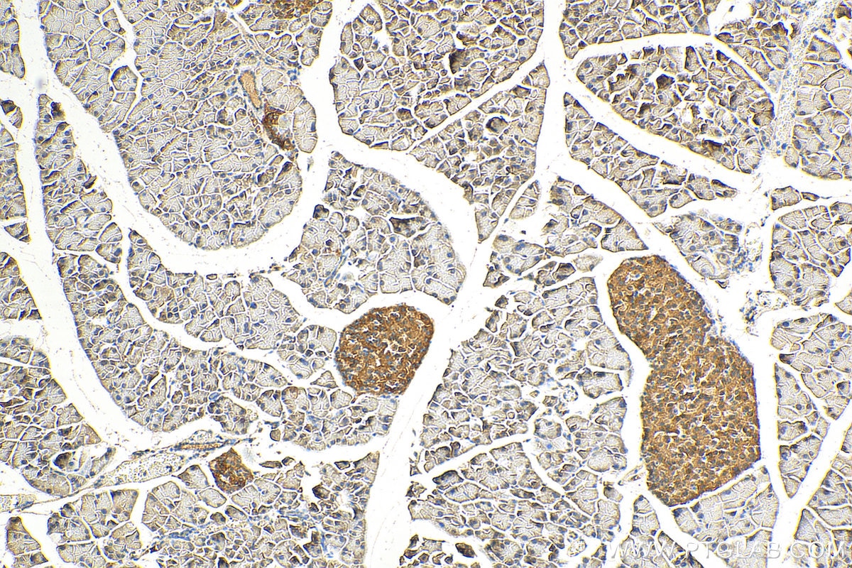 Immunohistochemistry (IHC) staining of mouse pancreas tissue using HHIP Polyclonal antibody (29466-1-AP)