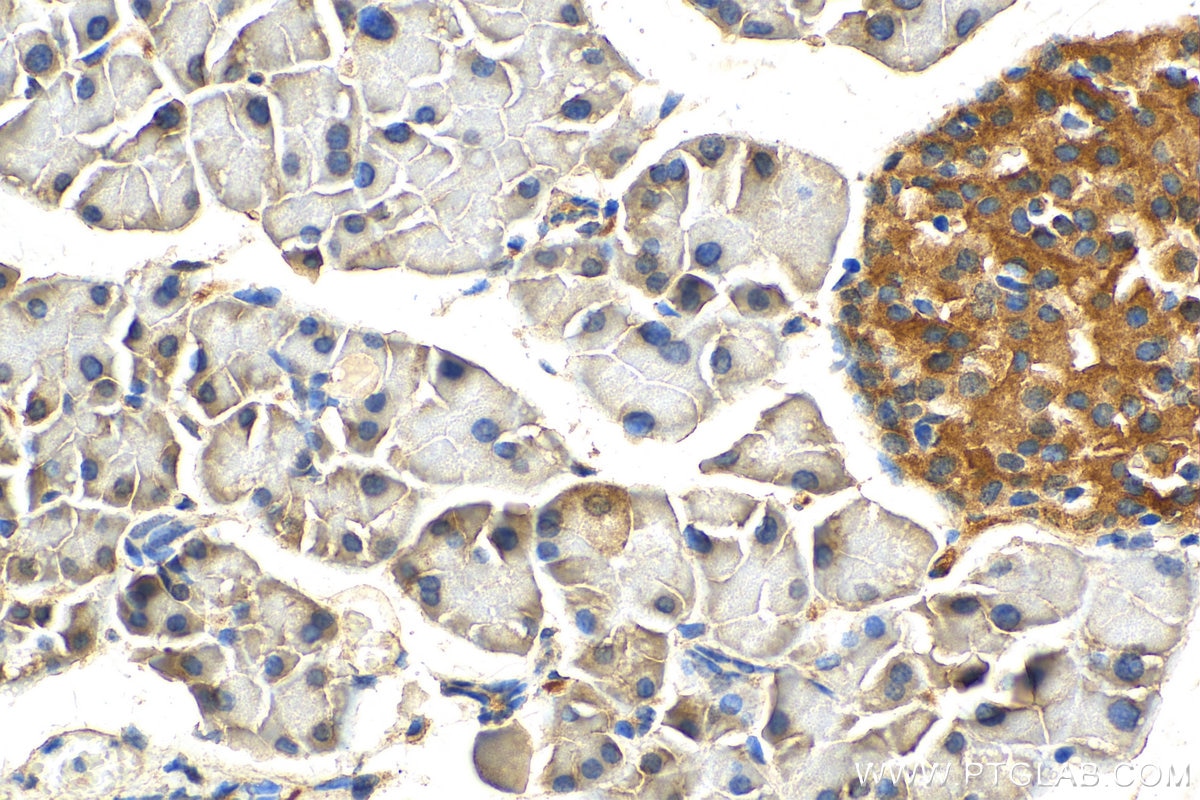 Immunohistochemistry (IHC) staining of mouse pancreas tissue using HHIP Polyclonal antibody (29466-1-AP)