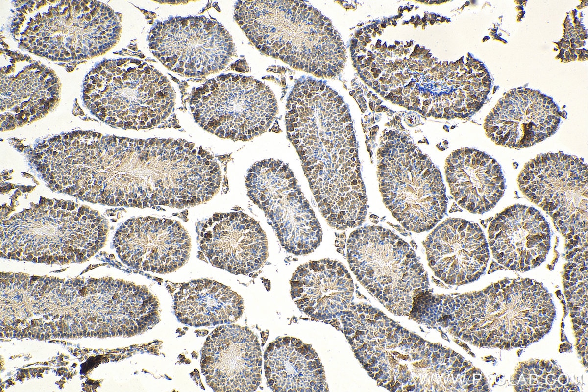 Immunohistochemistry (IHC) staining of mouse testis tissue using HHIP Polyclonal antibody (29466-1-AP)