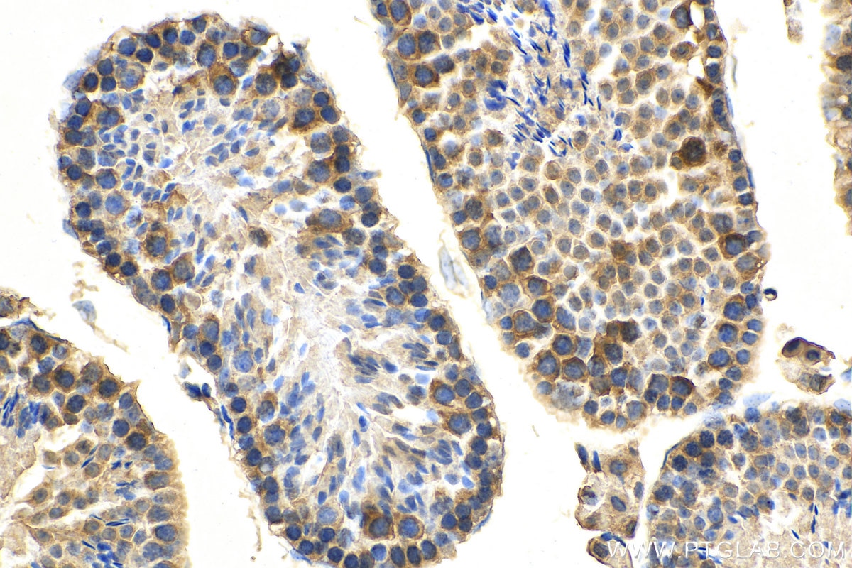 Immunohistochemistry (IHC) staining of mouse testis tissue using HHIP Polyclonal antibody (29466-1-AP)