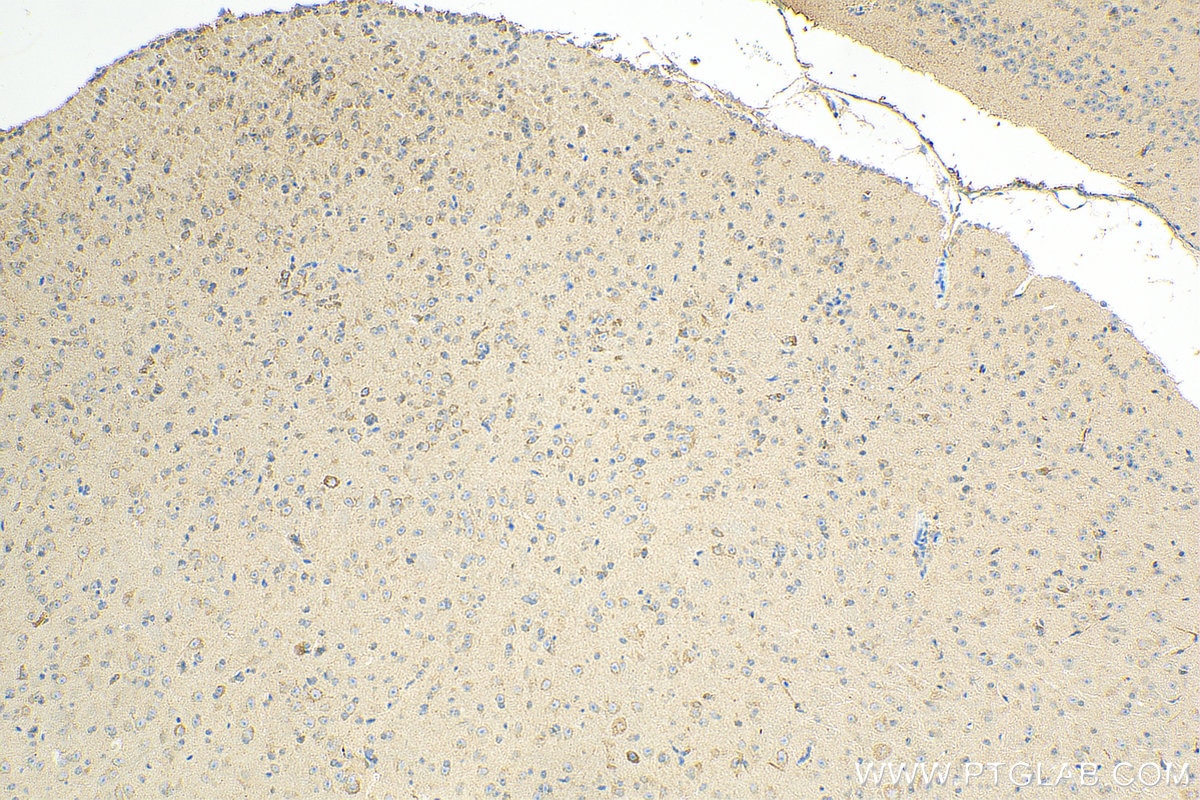 Immunohistochemistry (IHC) staining of mouse brain tissue using HHIP Polyclonal antibody (29466-1-AP)