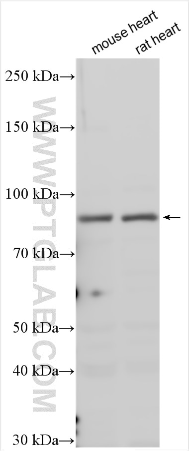 Western Blot (WB) analysis of various lysates using HHIP Polyclonal antibody (29466-1-AP)