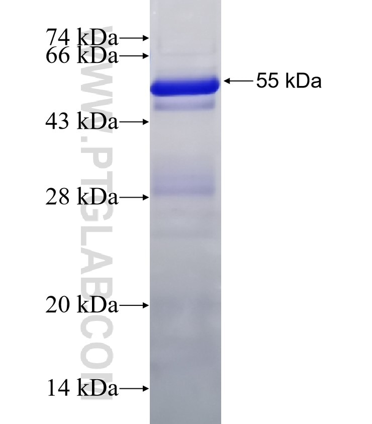 HHIP fusion protein Ag30869 SDS-PAGE
