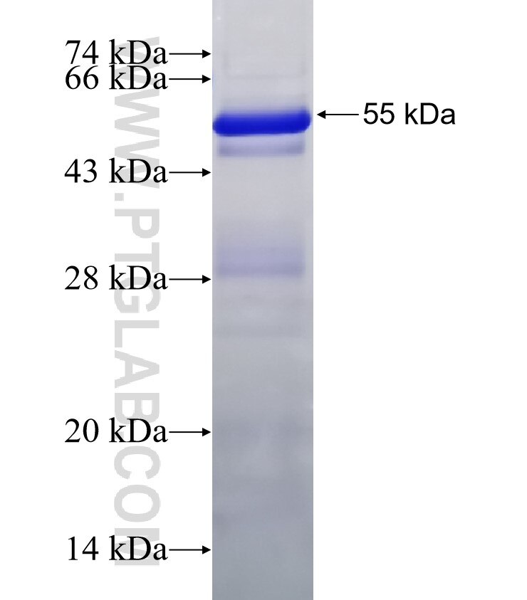 HHIP fusion protein Ag30869 SDS-PAGE