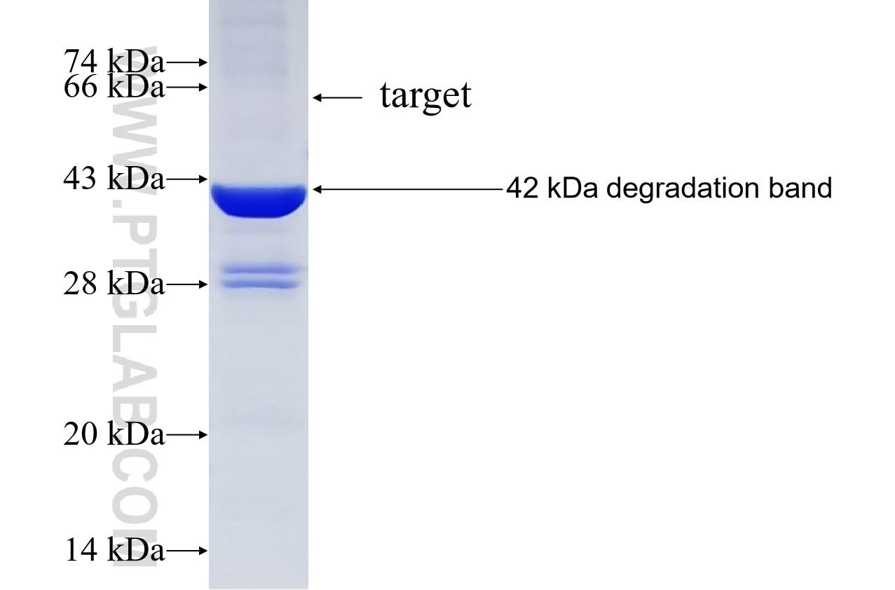 HHIP fusion protein Ag2241 SDS-PAGE