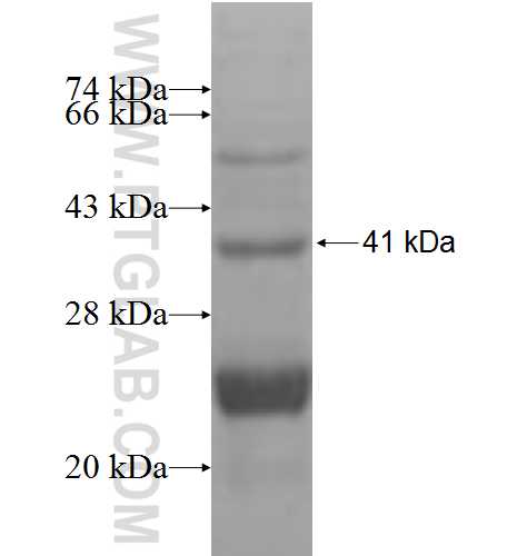 HIATL1 fusion protein Ag9617 SDS-PAGE