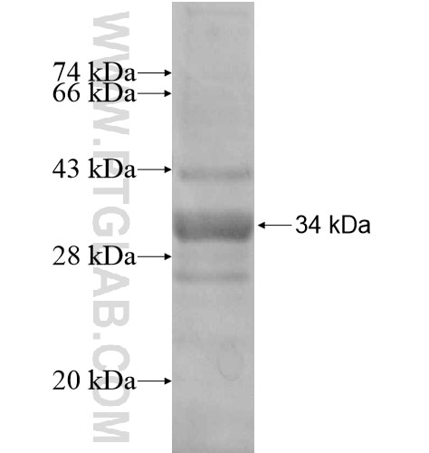 HIATL2 fusion protein Ag14570 SDS-PAGE