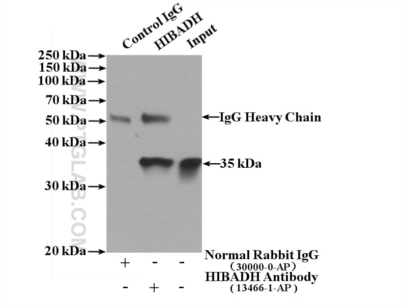 Immunoprecipitation (IP) experiment of mouse heart tissue using HIBADH Polyclonal antibody (13466-1-AP)