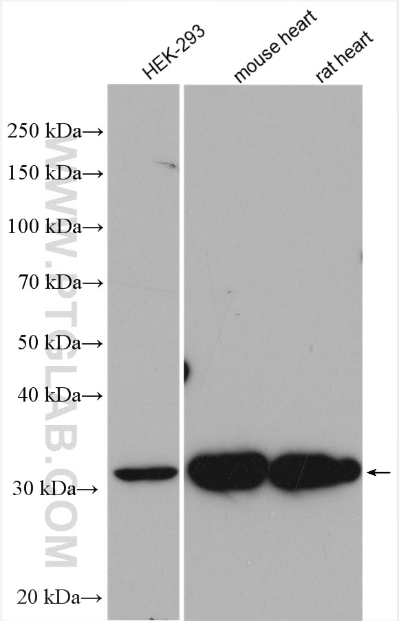 Western Blot (WB) analysis of various lysates using HIBADH Polyclonal antibody (13466-1-AP)