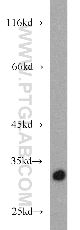 Western Blot (WB) analysis of mouse ovary tissue using HIBADH Polyclonal antibody (13466-1-AP)