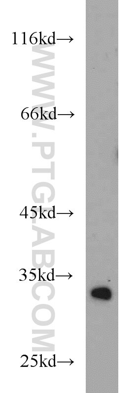 Western Blot (WB) analysis of mouse thymus tissue using HIBADH Polyclonal antibody (13466-1-AP)