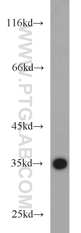 Western Blot (WB) analysis of mouse heart tissue using HIBADH Polyclonal antibody (13466-1-AP)