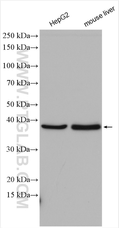 Western Blot (WB) analysis of various lysates using HIBCH Polyclonal antibody (14603-1-AP)