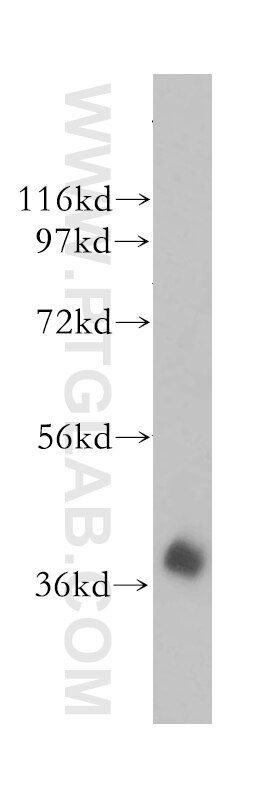 Western Blot (WB) analysis of human brain tissue using HIBCH Polyclonal antibody (14603-1-AP)