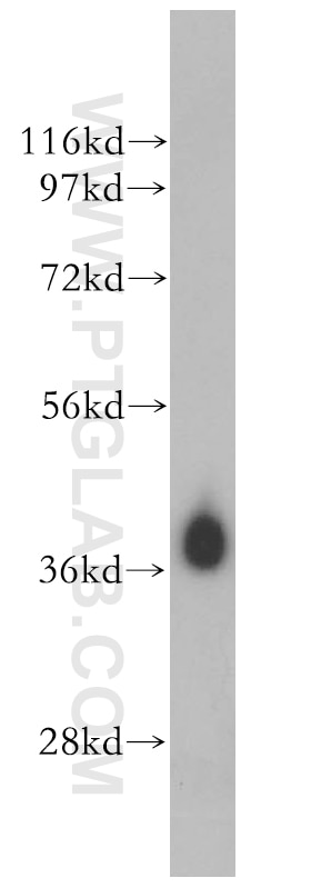 Western Blot (WB) analysis of human liver tissue using HIBCH Polyclonal antibody (14603-1-AP)