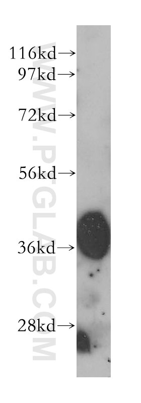 Western Blot (WB) analysis of human heart tissue using HIBCH Polyclonal antibody (14603-1-AP)