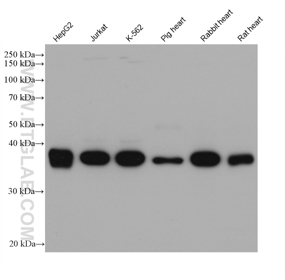 Western Blot (WB) analysis of various lysates using HIBCH Monoclonal antibody (68157-1-Ig)