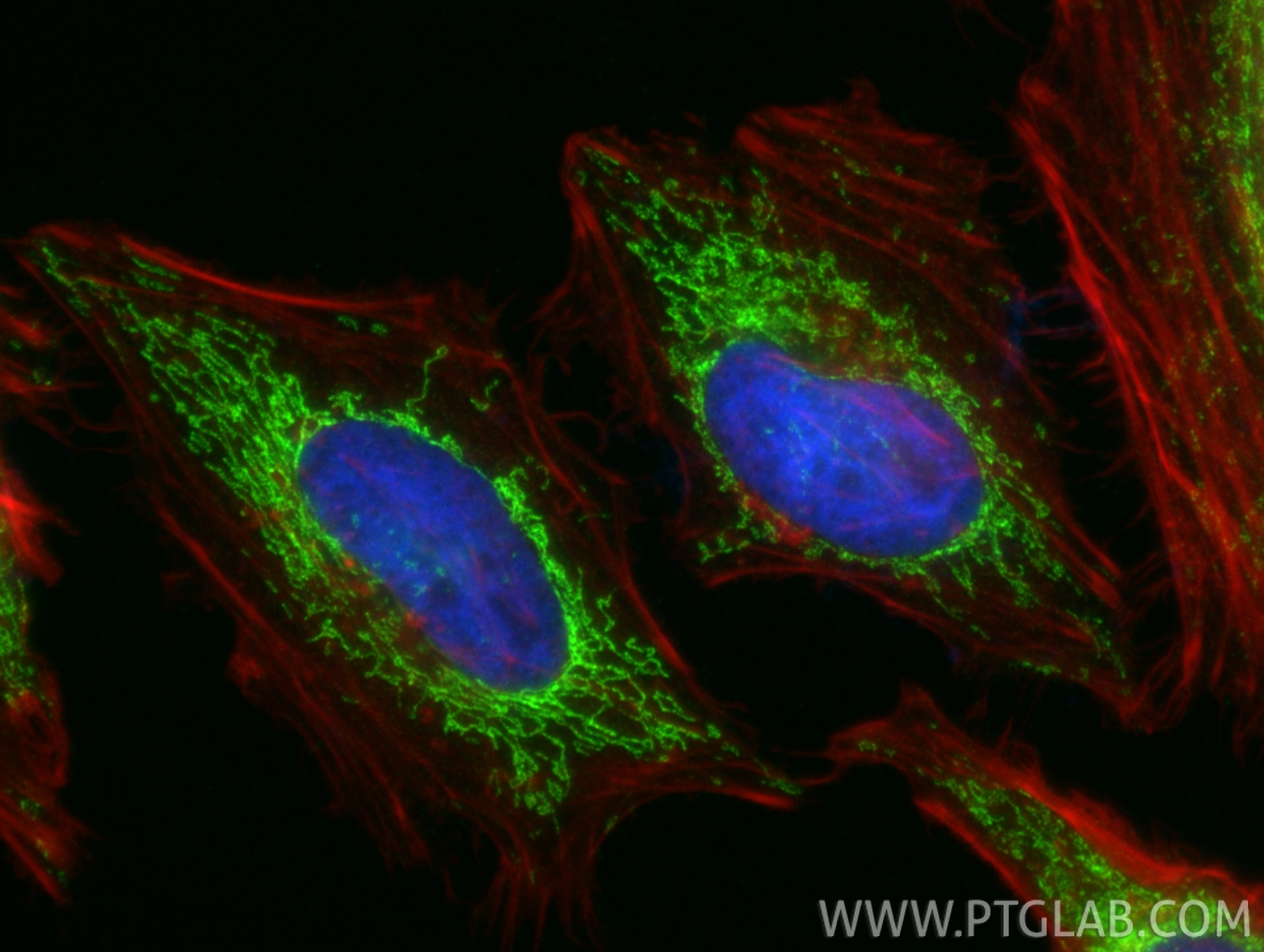 Immunofluorescence (IF) / fluorescent staining of HeLa cells using HIBCH Recombinant antibody (83569-1-RR)