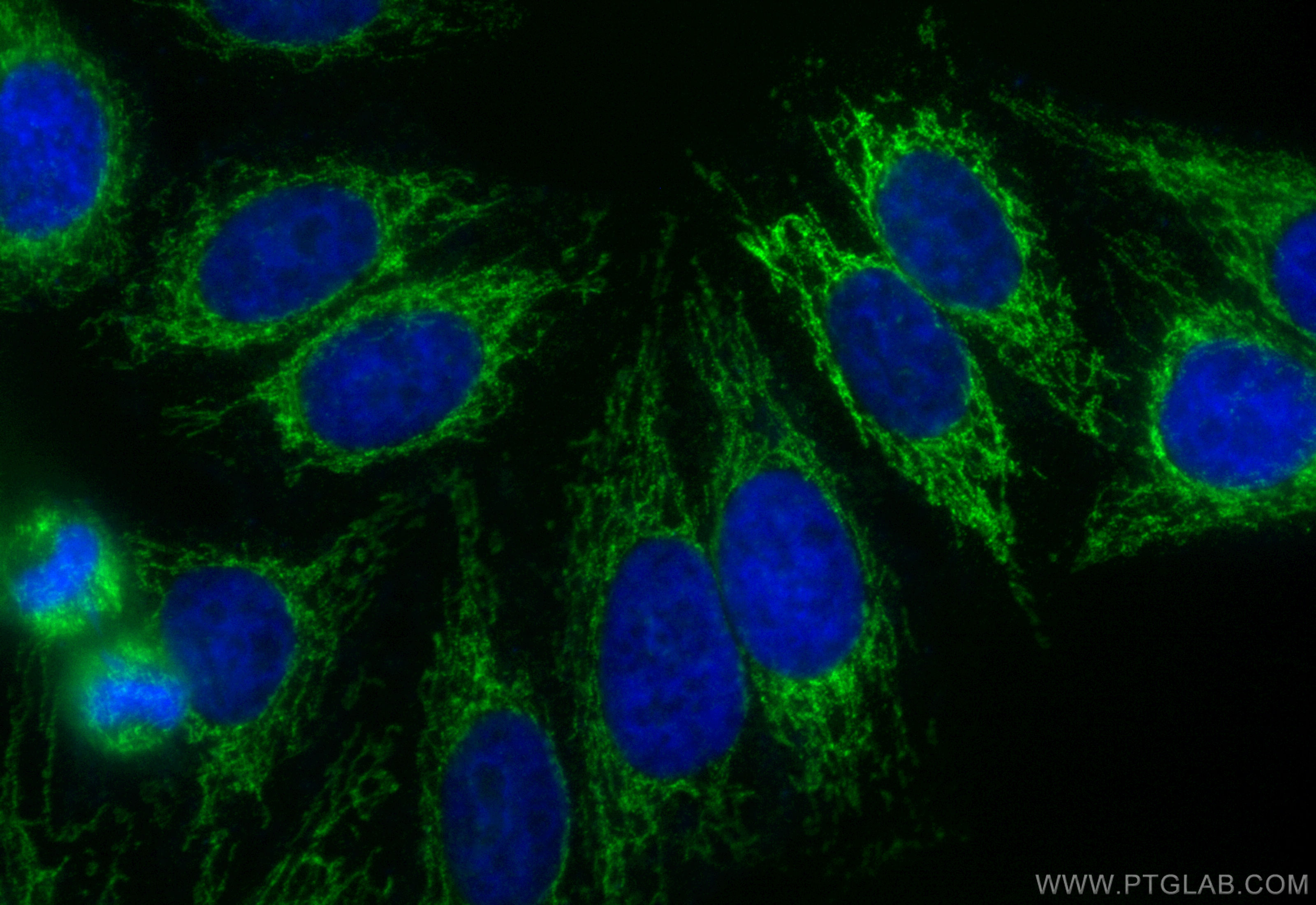 Immunofluorescence (IF) / fluorescent staining of HepG2 cells using CoraLite® Plus 488-conjugated HIBCH Recombinant an (CL488-83569)