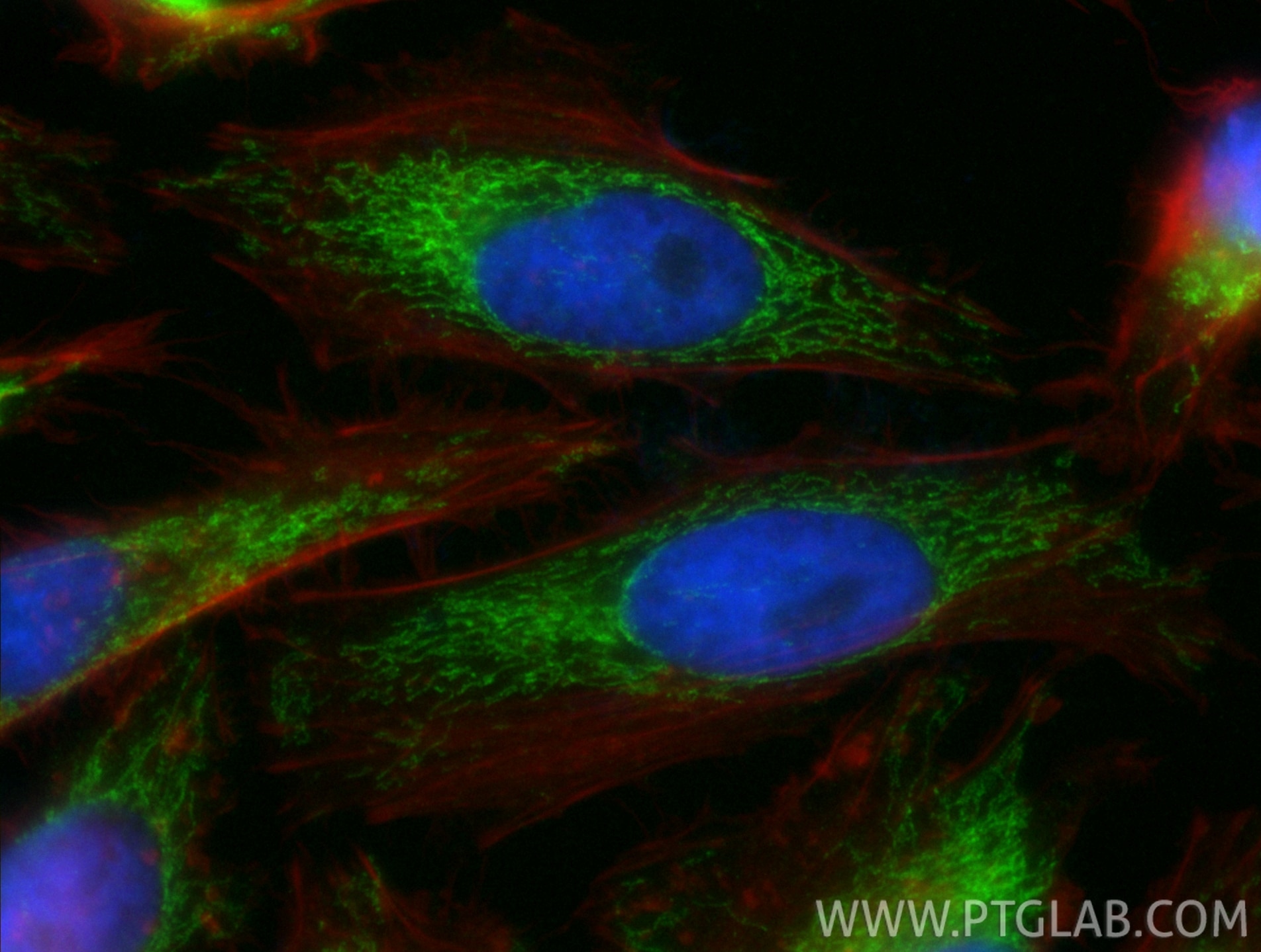 Immunofluorescence (IF) / fluorescent staining of HeLa cells using CoraLite® Plus 488-conjugated HIBCH Recombinant an (CL488-83569)
