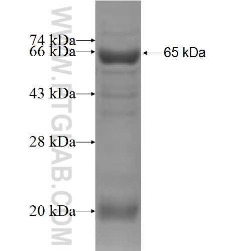 HIBCH fusion protein Ag6149 SDS-PAGE