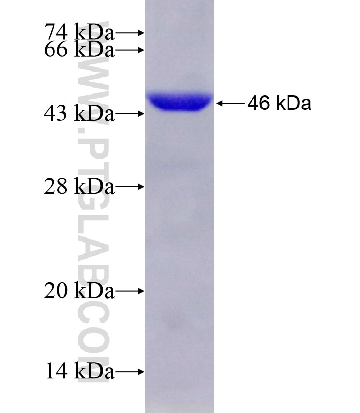 HIBCH fusion protein Ag6473 SDS-PAGE