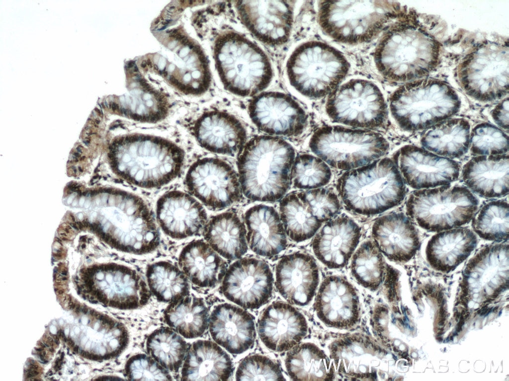 IHC staining of human colon using 24949-1-AP