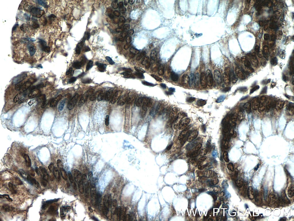 IHC staining of human colon using 24949-1-AP