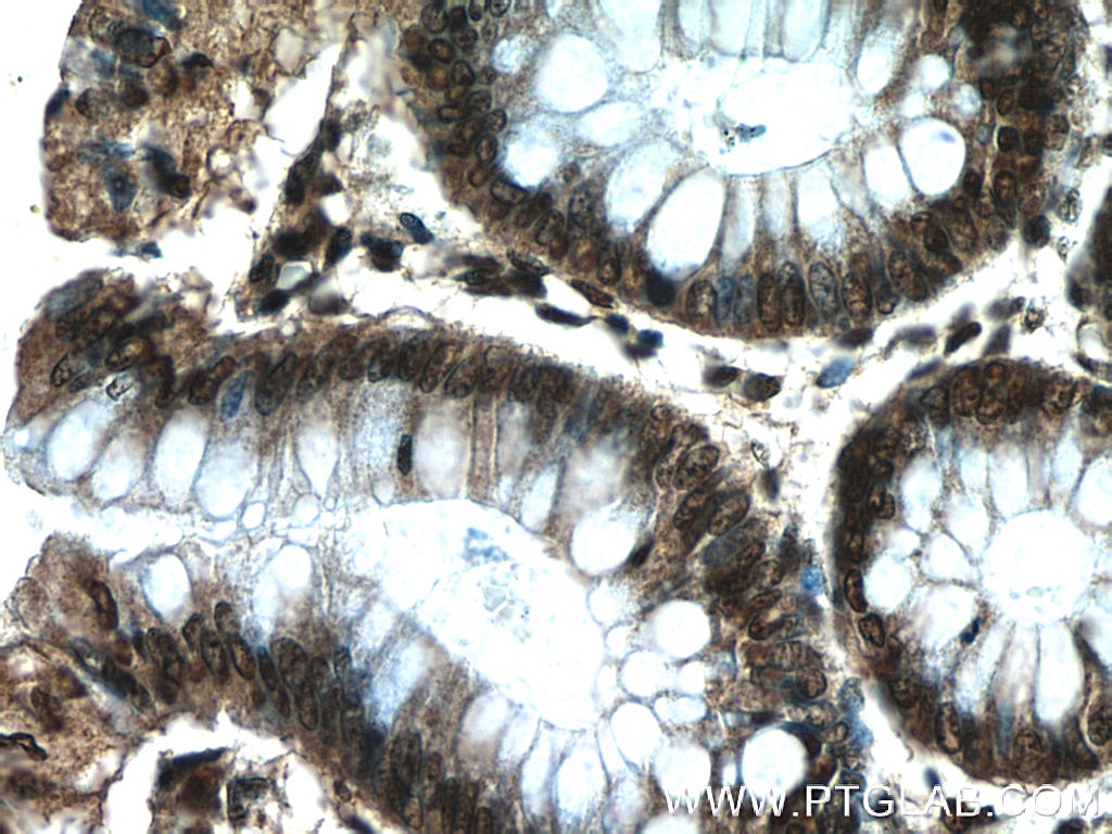 Immunohistochemistry (IHC) staining of human colon tissue using HIC1 Polyclonal antibody (24949-1-AP)