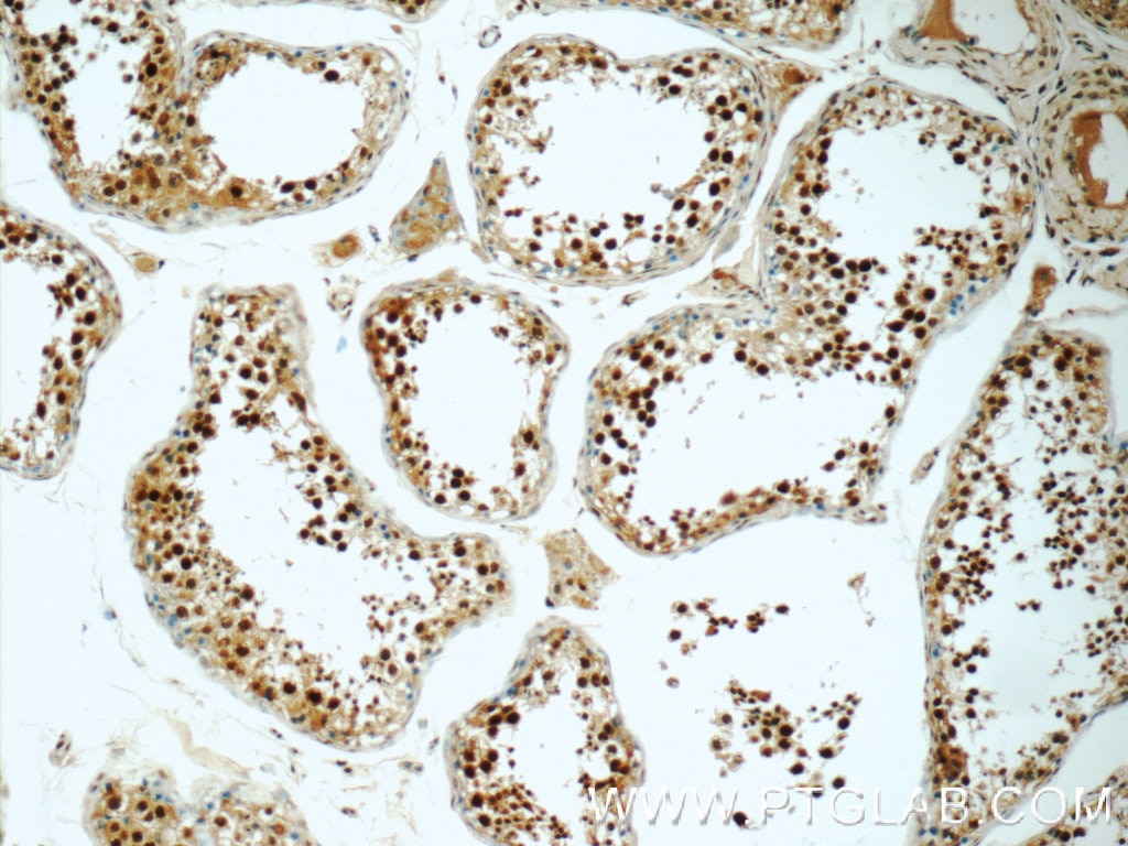 Immunohistochemistry (IHC) staining of human testis tissue using HIC1 Polyclonal antibody (24949-1-AP)