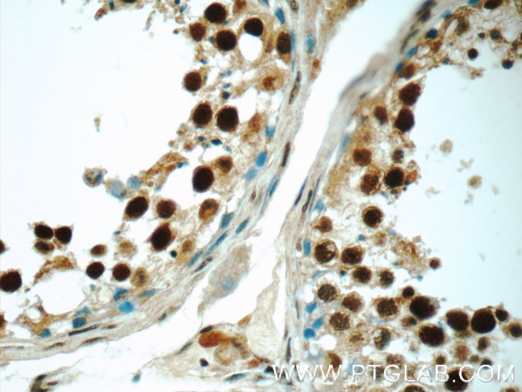 Immunohistochemistry (IHC) staining of human testis tissue using HIC1 Polyclonal antibody (24949-1-AP)