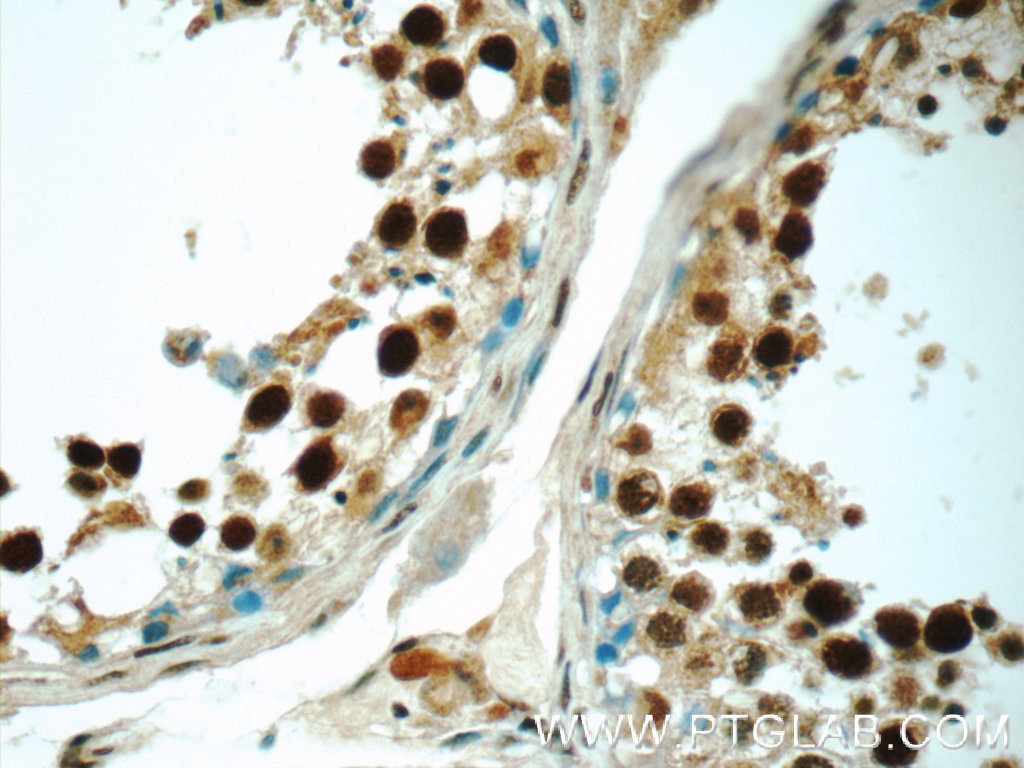 IHC staining of human testis using 24949-1-AP