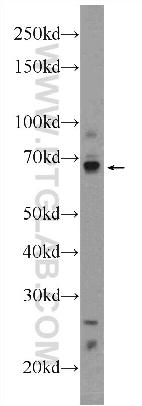 Western Blot (WB) analysis of NIH/3T3 cells using HIC1 Polyclonal antibody (24949-1-AP)