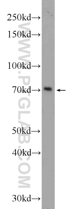 Western Blot (WB) analysis of Jurkat cells using HIC1 Polyclonal antibody (24949-1-AP)