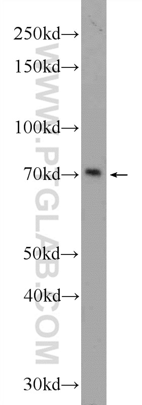 WB analysis of Jurkat using 24949-1-AP