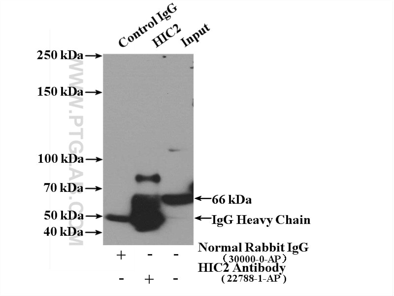 Immunoprecipitation (IP) experiment of Jurkat cells using HIC2 Polyclonal antibody (22788-1-AP)