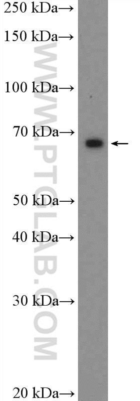 Western Blot (WB) analysis of Jurkat cells using HIC2 Polyclonal antibody (22788-1-AP)