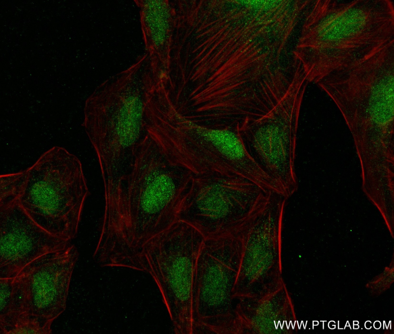 Immunofluorescence (IF) / fluorescent staining of U2OS cells using HIC2 Recombinant antibody (83162-7-RR)