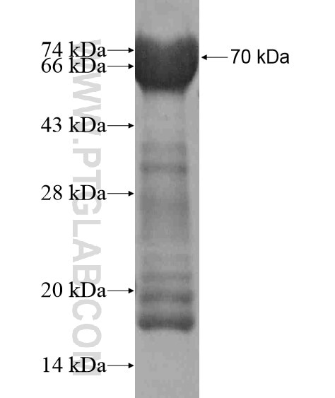 HIC2 fusion protein Ag18789 SDS-PAGE