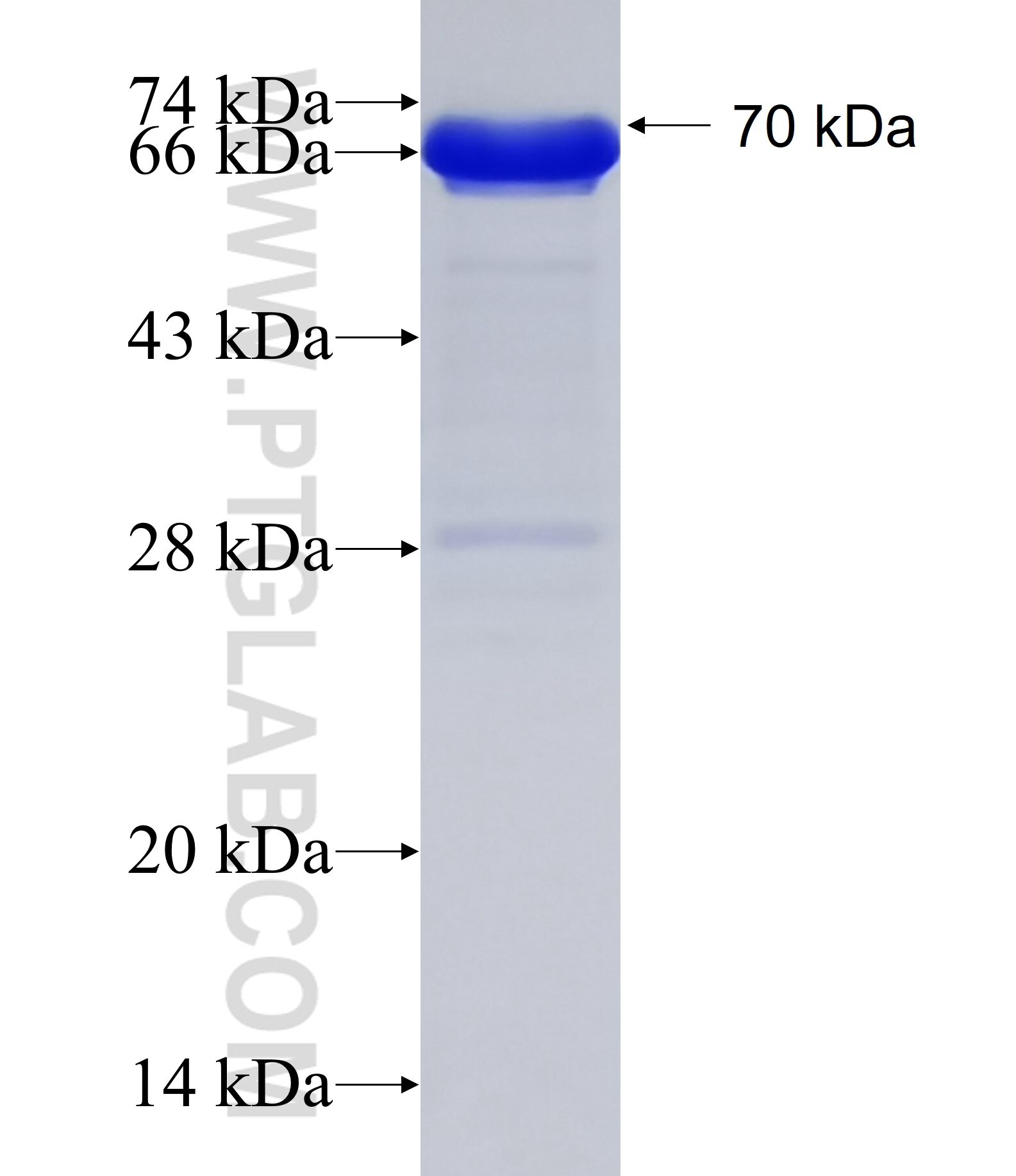 HIC2 fusion protein Ag18789 SDS-PAGE