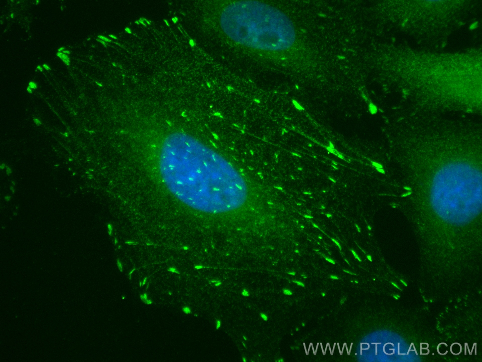 Immunofluorescence (IF) / fluorescent staining of A549 cells using CoraLite® Plus 488-conjugated HIC5 Polyclonal anti (CL488-10565)