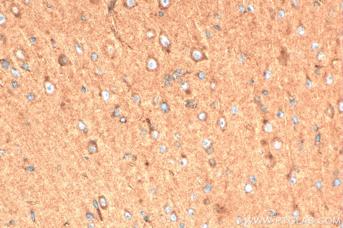 Immunohistochemistry (IHC) staining of mouse brain tissue using HICE1 Polyclonal antibody (33973-1-AP)