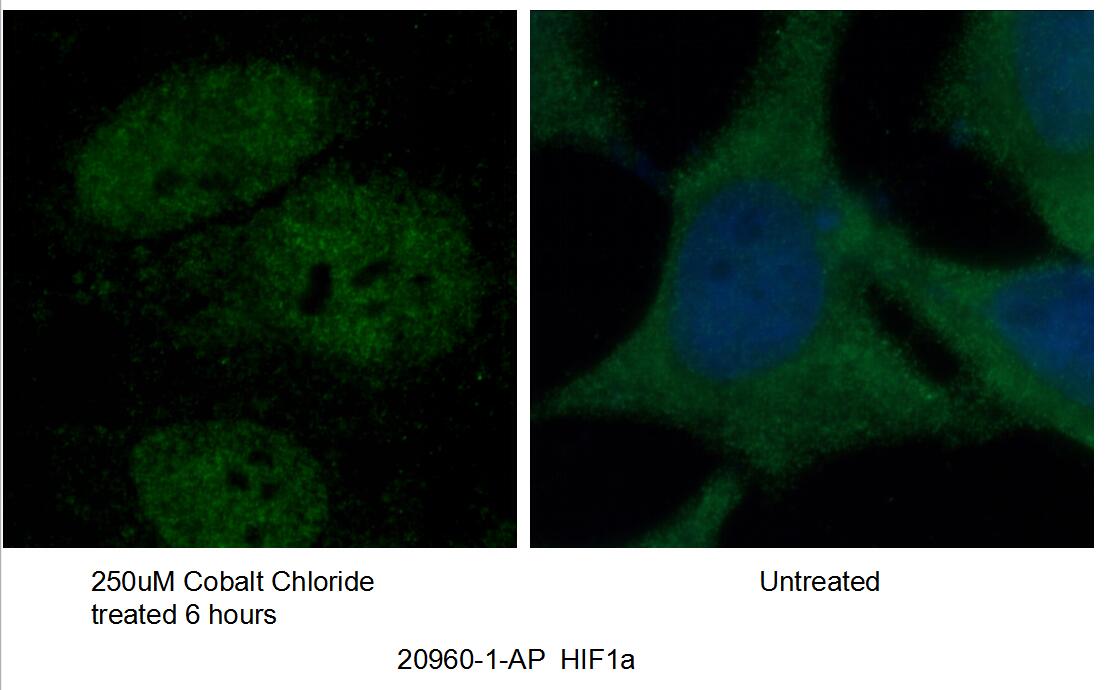 Immunofluorescence (IF) / fluorescent staining of HeLa cells using HIF1a Polyclonal antibody (20960-1-AP)