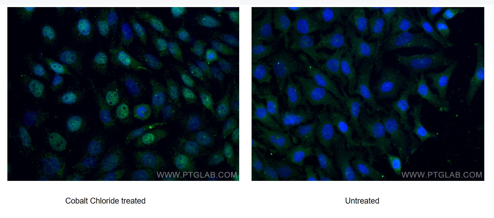 Immunofluorescence (IF) / fluorescent staining of HeLa cells using HIF-1 alpha Polyclonal antibody (20960-1-AP)