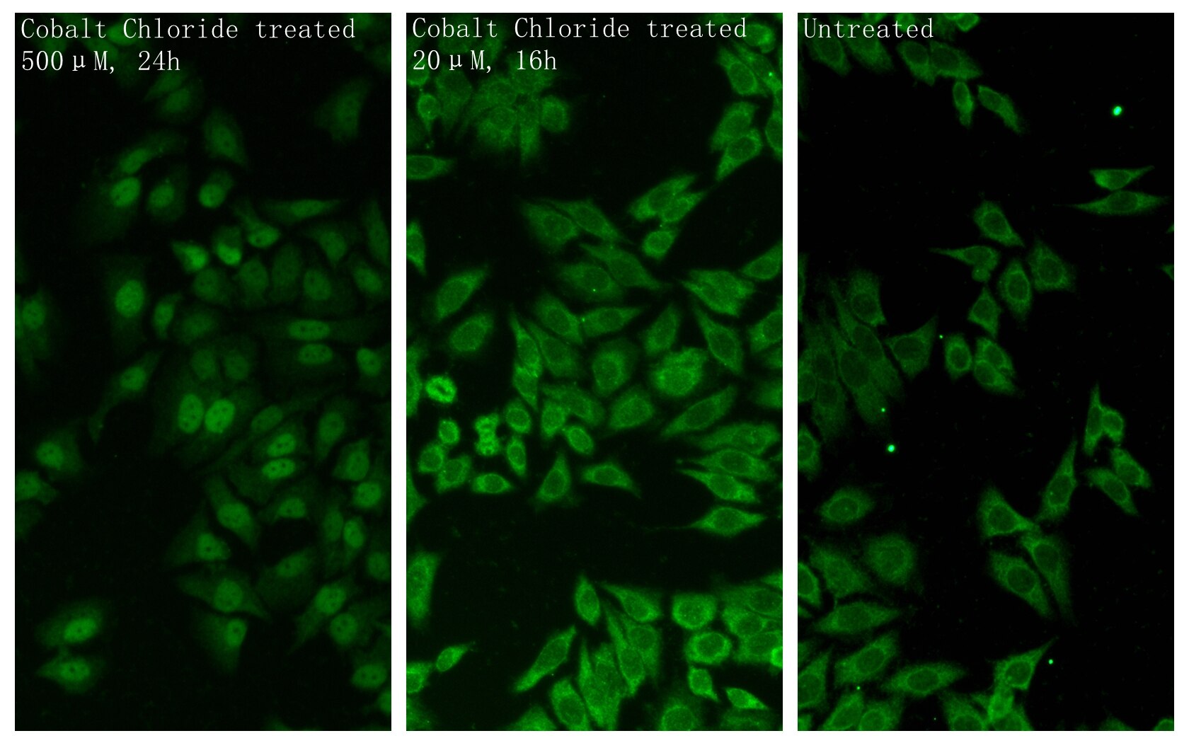 Immunofluorescence (IF) / fluorescent staining of HepG2 cells using HIF1a Polyclonal antibody (20960-1-AP)